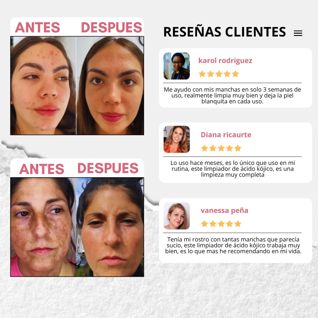 KOJICWASH: Elimina células muertas, hiperpigmentación y manchas 2X1