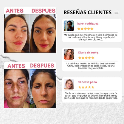 KOJICWASH: Elimina células muertas, hiperpigmentación y manchas 2X1